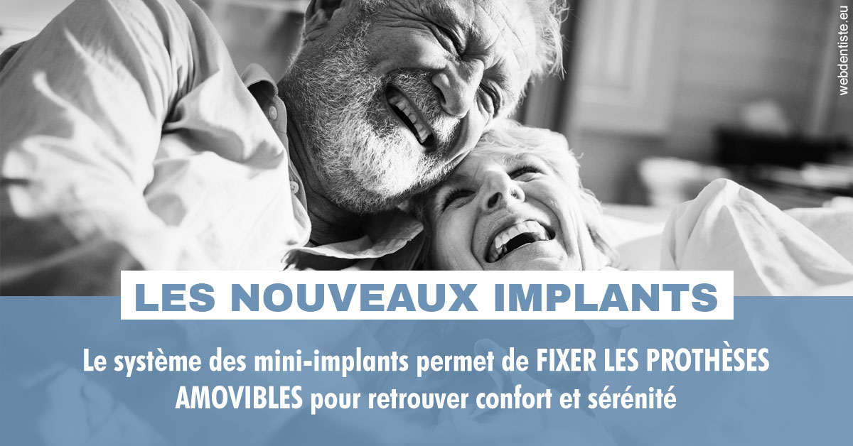 https://dr-nicolas-cecile.chirurgiens-dentistes.fr/Les nouveaux implants 2