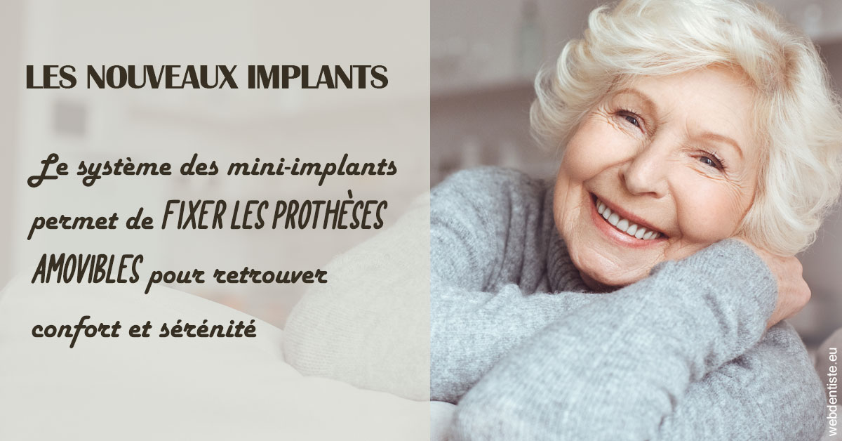 https://dr-nicolas-cecile.chirurgiens-dentistes.fr/Les nouveaux implants 1
