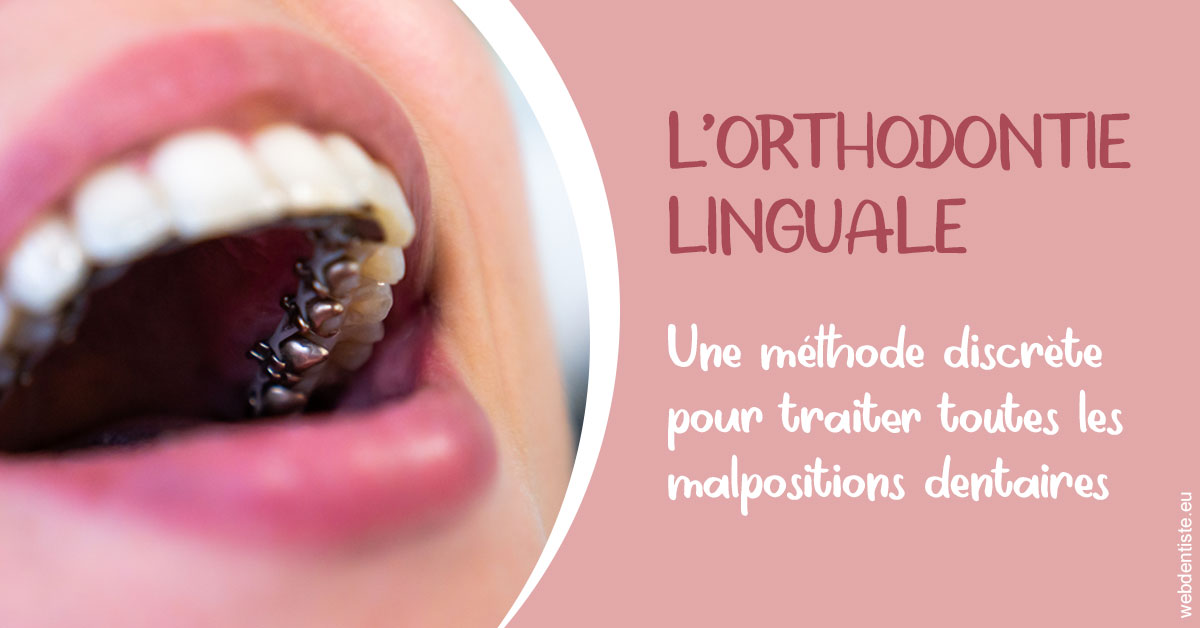 https://dr-nicolas-cecile.chirurgiens-dentistes.fr/L'orthodontie linguale 2