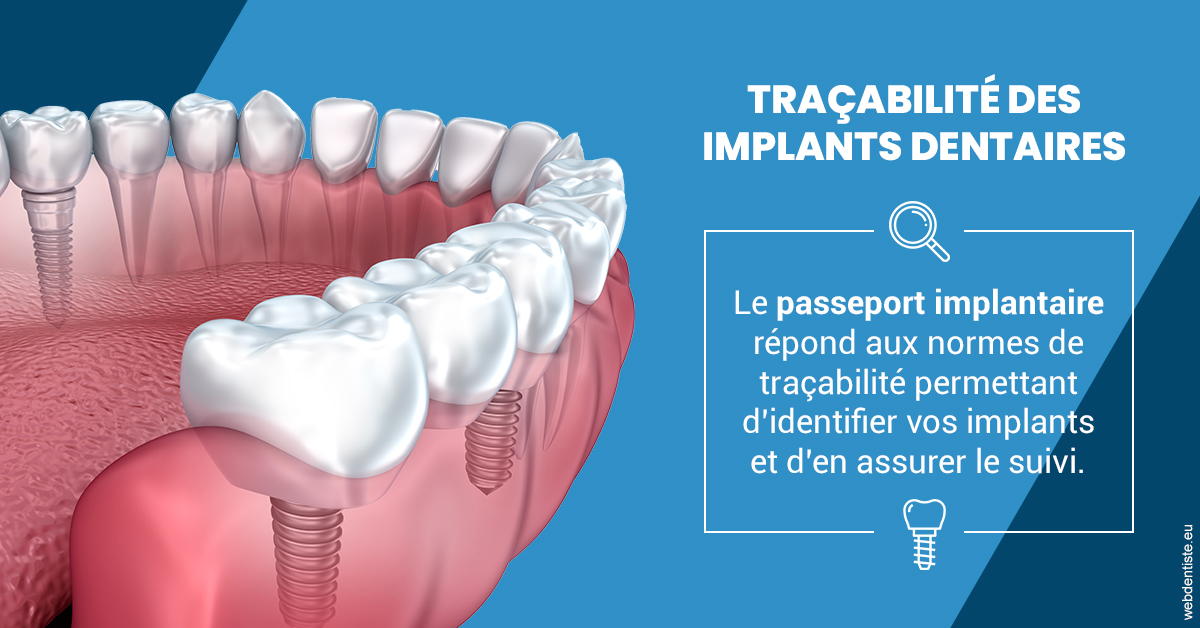 https://dr-nicolas-cecile.chirurgiens-dentistes.fr/T2 2023 - Traçabilité des implants 1