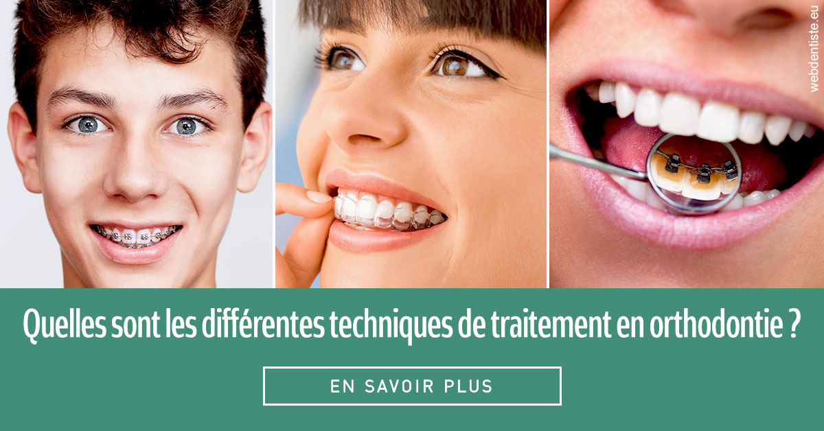 https://dr-nicolas-cecile.chirurgiens-dentistes.fr/Les différentes techniques de traitement 2