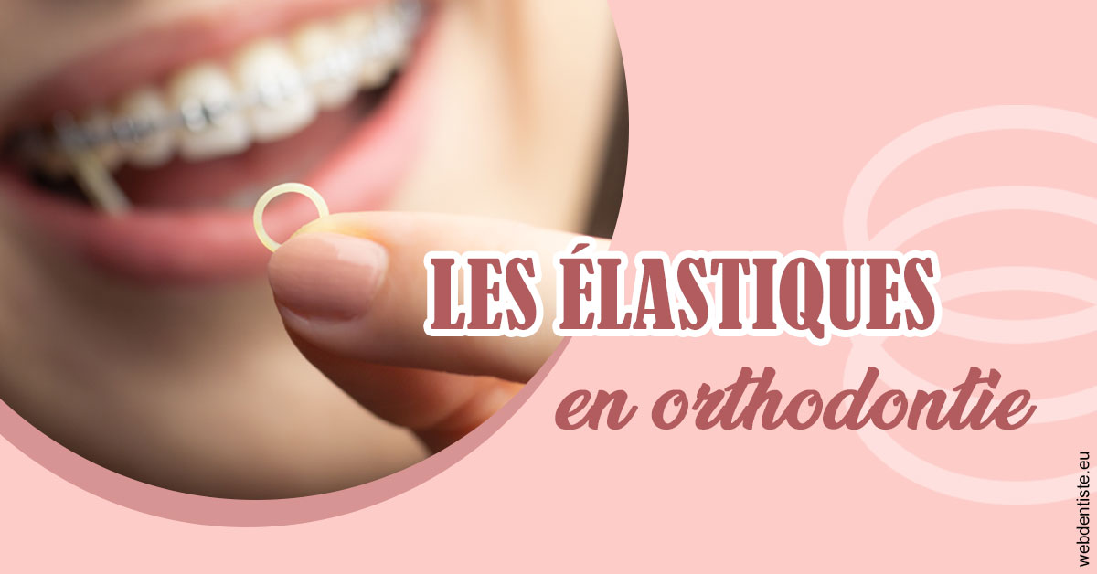 https://dr-nicolas-cecile.chirurgiens-dentistes.fr/Elastiques orthodontie 1