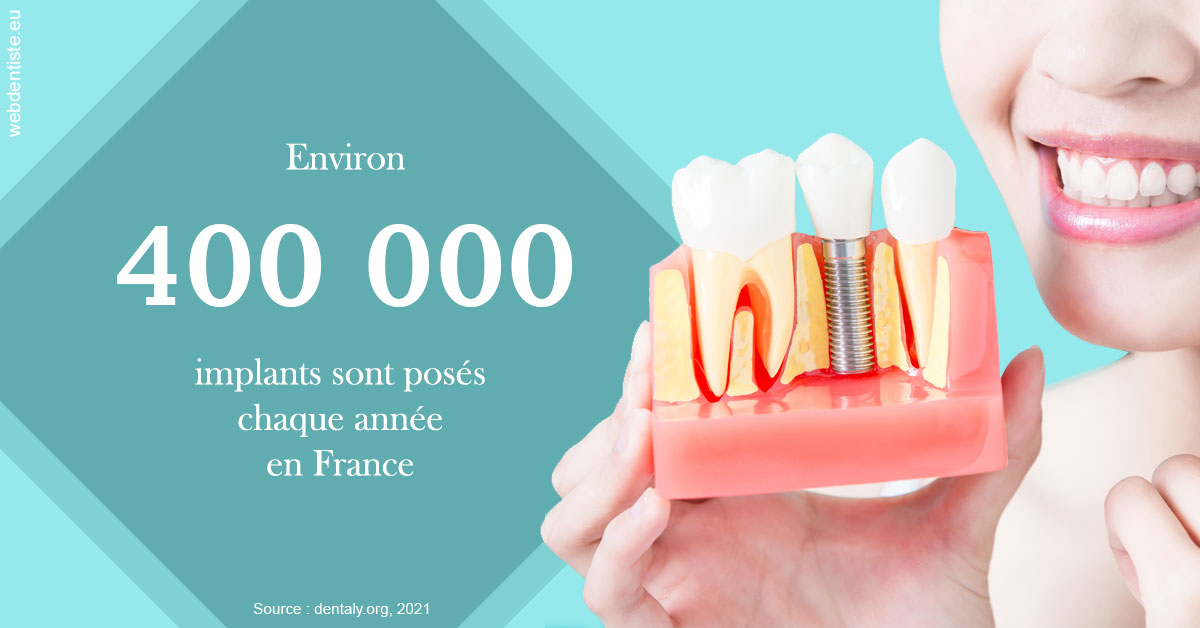 https://dr-nicolas-cecile.chirurgiens-dentistes.fr/Pose d'implants en France 2