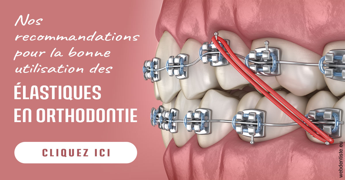 https://dr-nicolas-cecile.chirurgiens-dentistes.fr/Elastiques orthodontie 2